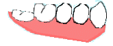 背の低い歯（大人の歯が半分でている）